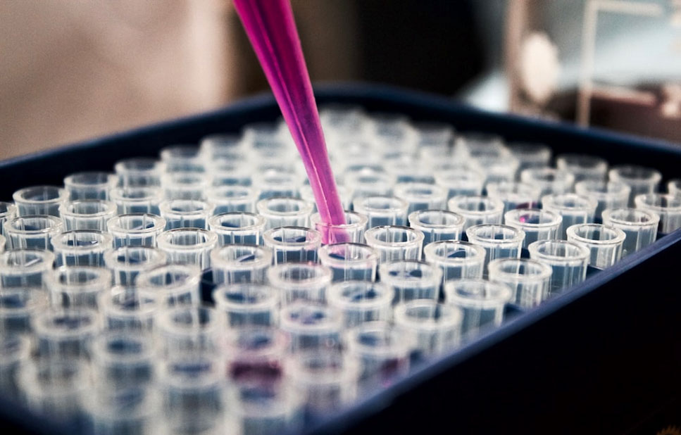 Free Postal Test Kits